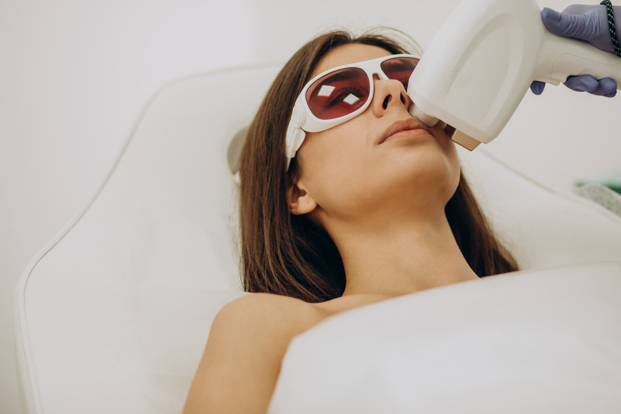 Best Laser Acne Scar Removal in Bhilai Causes Treatments Results