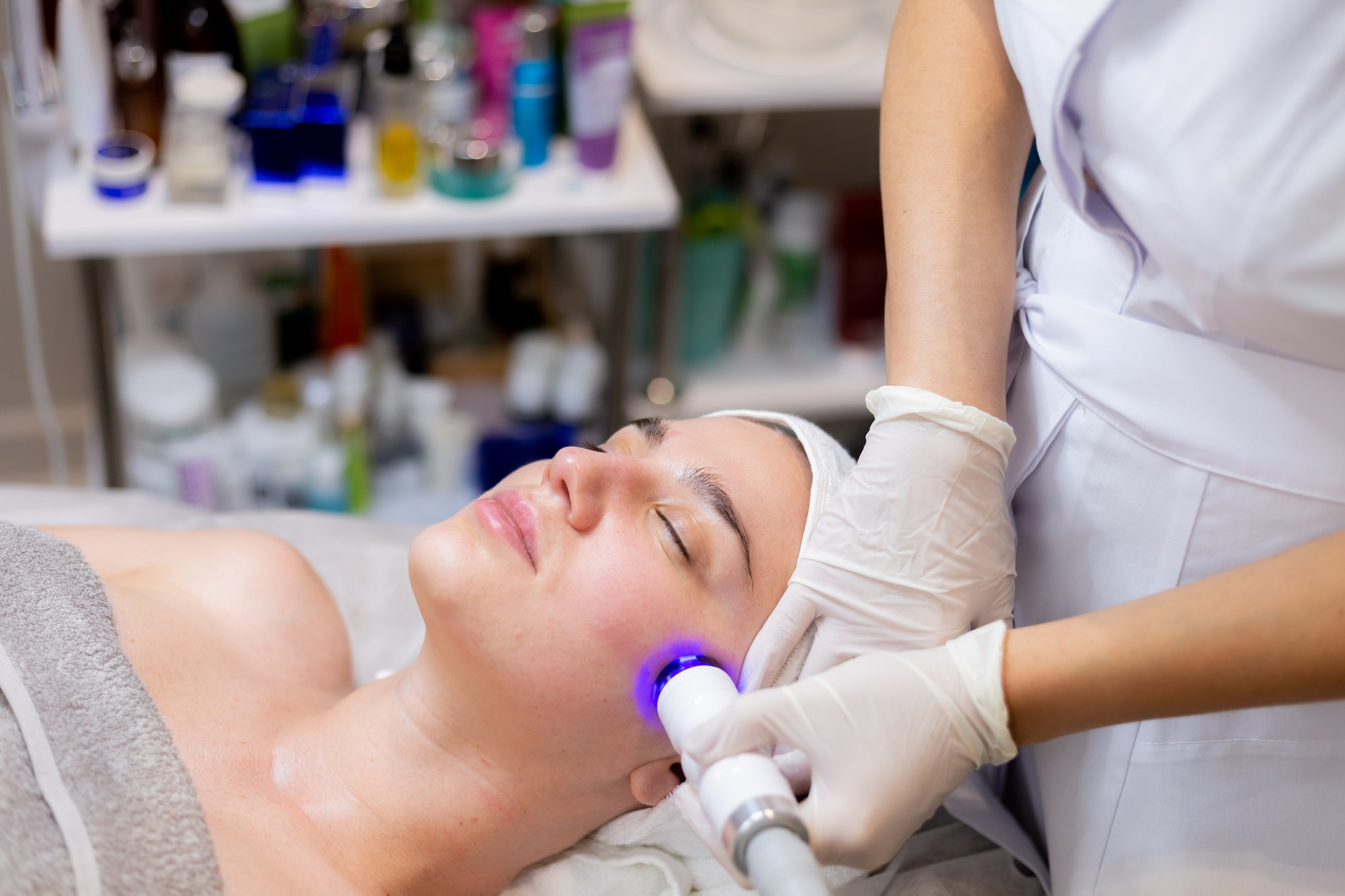 Laser Acne Scar Removal in Bhilai: Causes Treatments Results